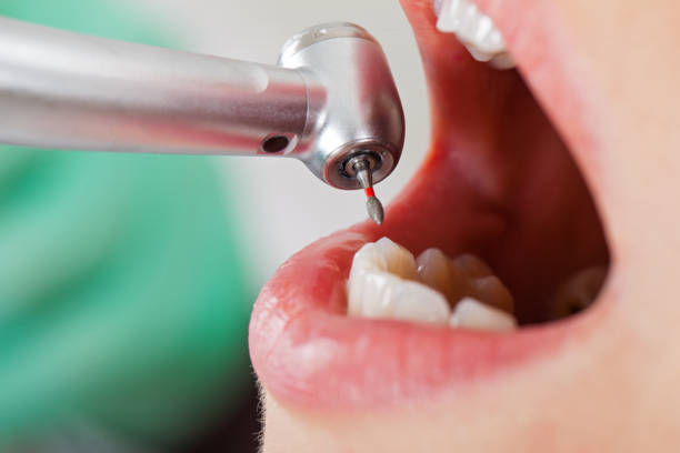 Best Emergency Treatment for Oral Infections in USA